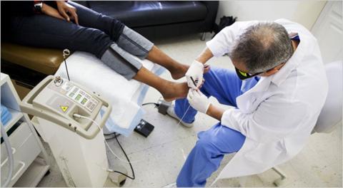 laser surgery on toenail laser surgery on toenail